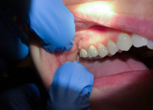 Best Tooth Pain Emergency Relief  in Shenandoah, LA